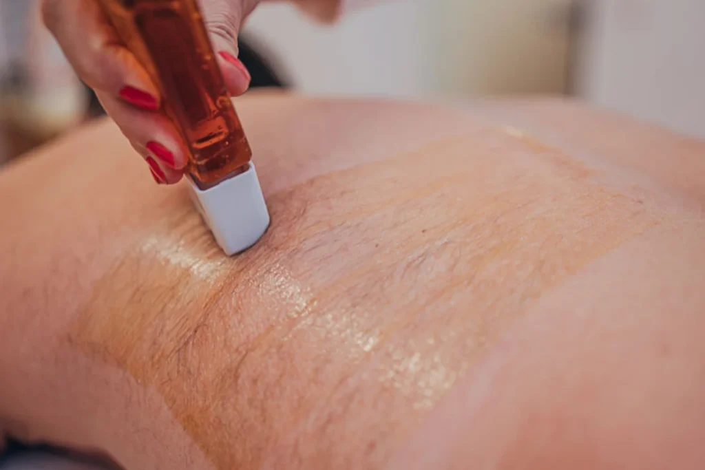 Professionelle Körper-Haarentfernung im Kosmetikstudio Augsburg