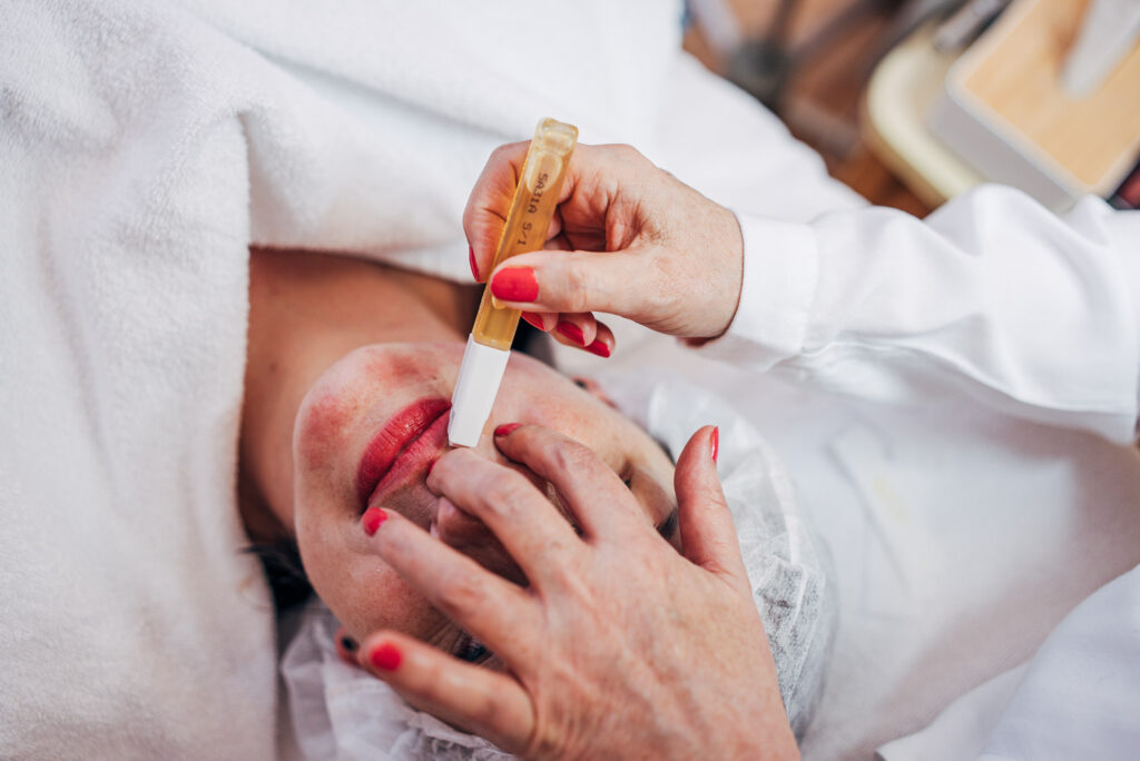 Professionelle Haarentfernung im Gesicht in Augsburg