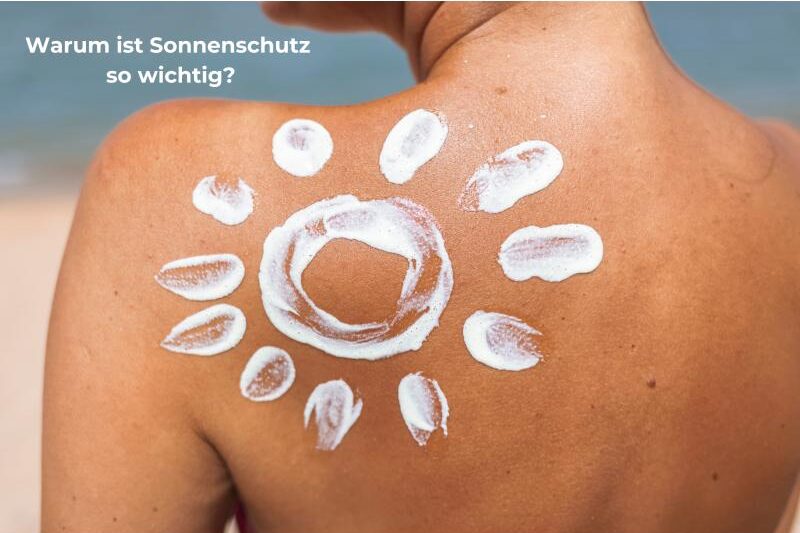 Sonnencreme in Sonnenform auf den Rücken aufgetragen als Symbol für täglichen UV-Schutz
